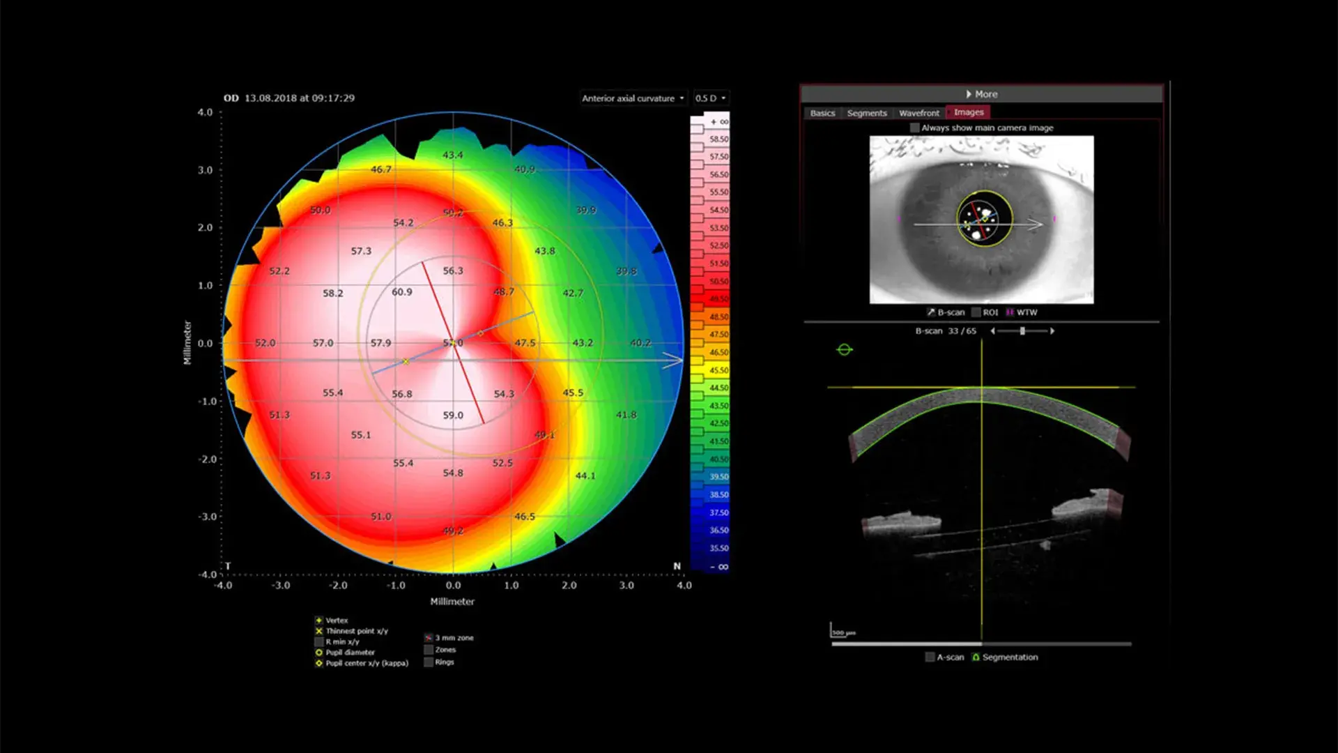 tecnología a la vanguardia en oftalmología