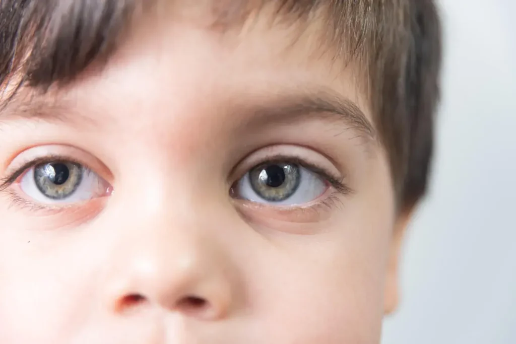 por qué da un tic en el ojo en niños pequeños