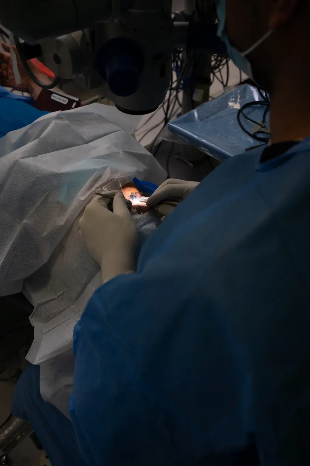 Cirugia Laser